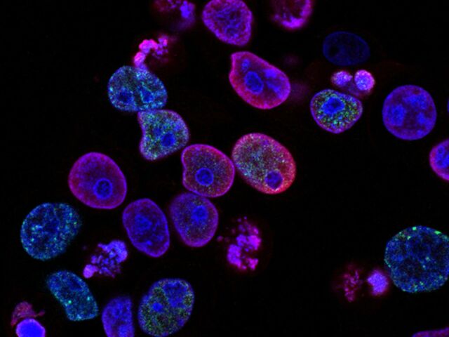 national-cancer-institute-L7en7Lb-Ovc-unsplash