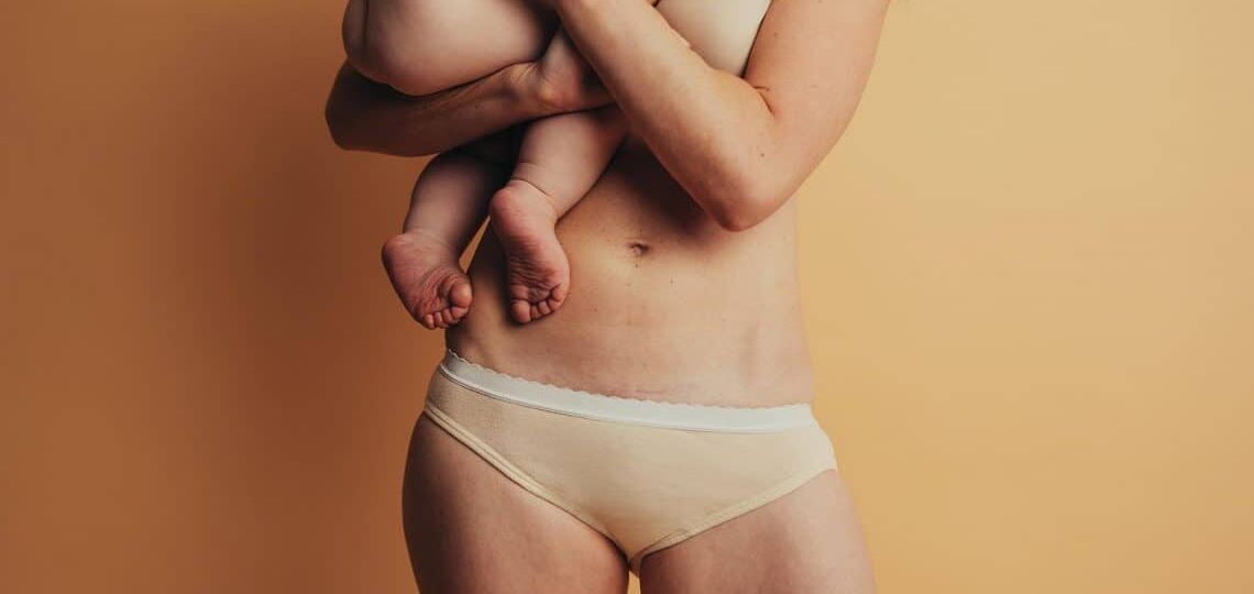 RS_Mommy-makeover-advice-1140x821