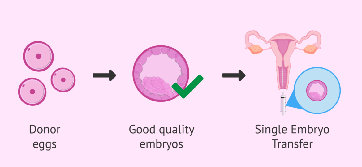 Surrogate embryo transfer