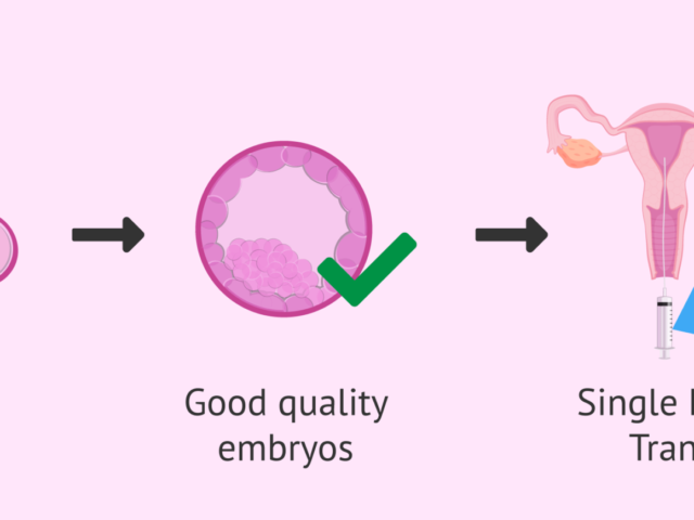 Surrogate embryo transfer